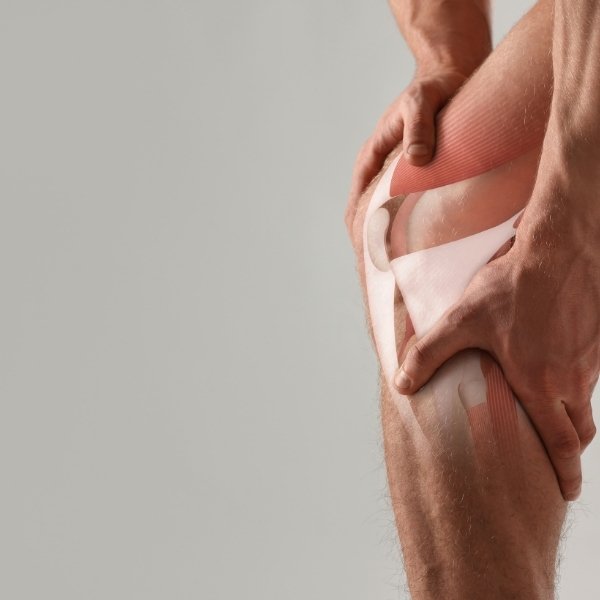 Tratamiento de Luxación de Rótula en Santa Cruz